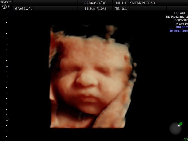 Black hair 3d outlet ultrasound